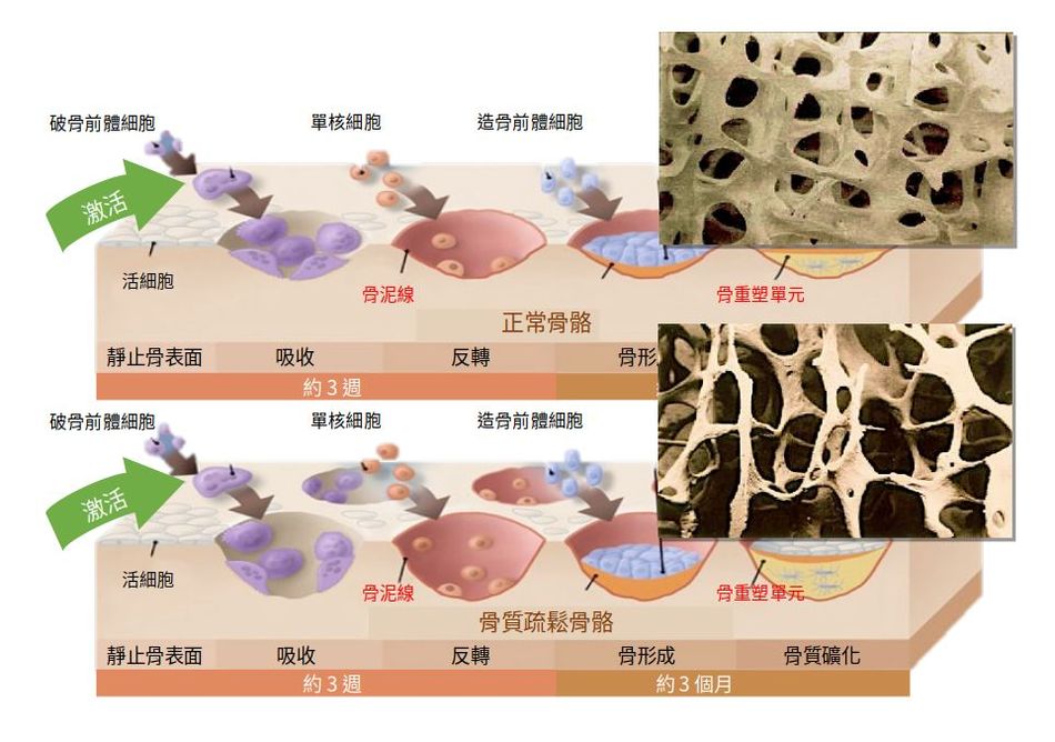 骨科 – 宇宏生物科技PROBONE